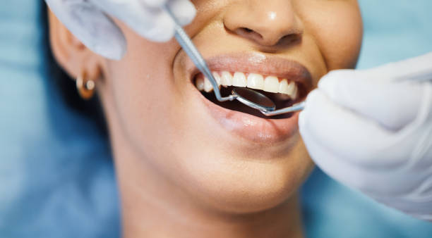 Best Emergency Wisdom Tooth Extraction in Wyoming, MN